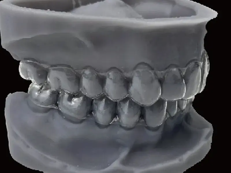 Clear-aligner dental model